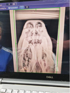 Radiografía de la cabeza